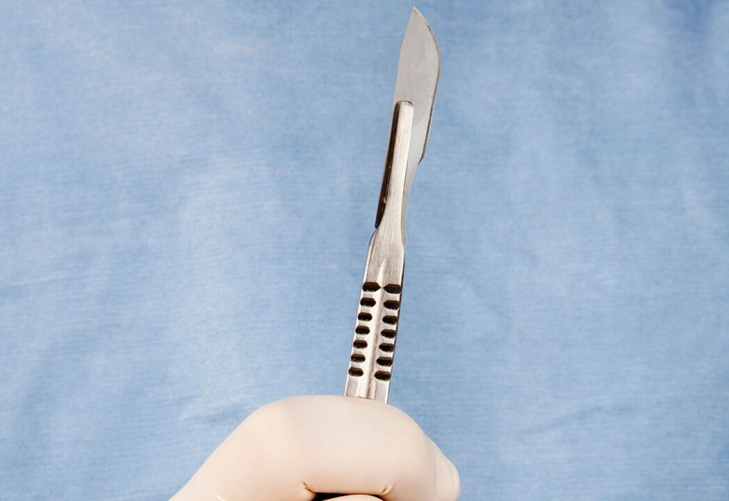 Bisturi per la chirurgia dell'ingrandimento del pene