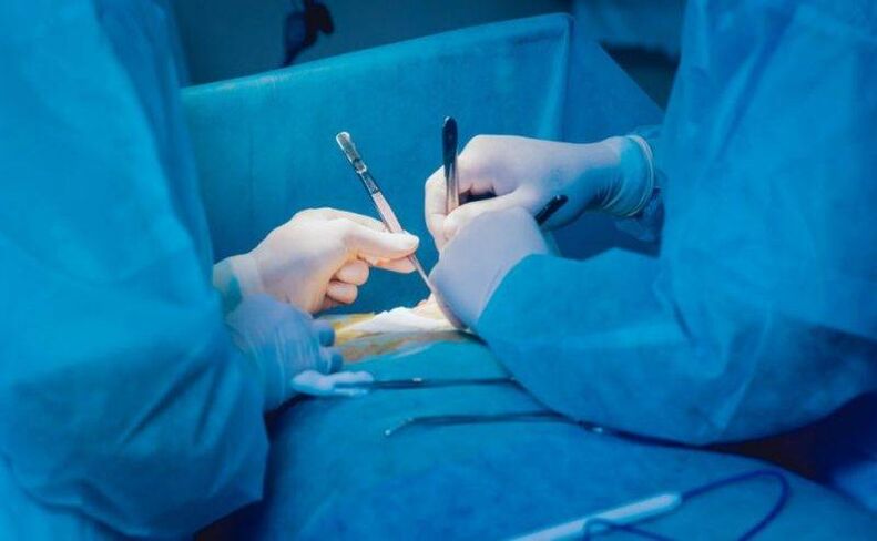 intervento chirurgico per l'ingrandimento del pene